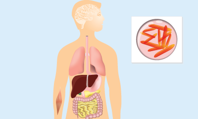 Legionella Management